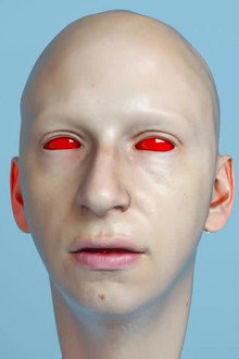 Face Lift