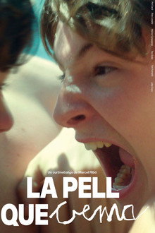La pell que crema