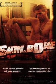 Skin & Bone
