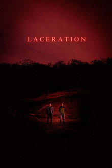 Laceration
