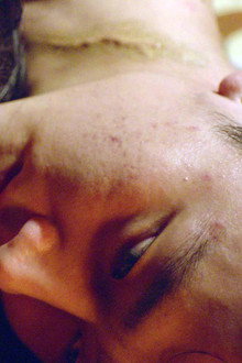 Blind Massage