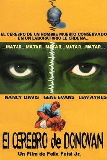 El cerebro de Donovan