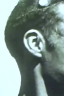 Rabies in a Human Patient