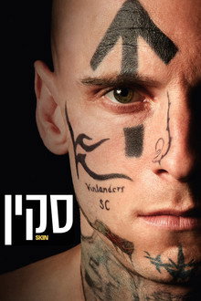 סקין