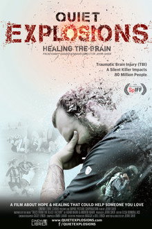 Quiet Explosions: Healing the Brain