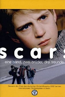 Scars