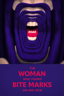 Poster do filme Roar: The Woman Who Found Bite Marks On Her Skin