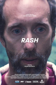 Rash