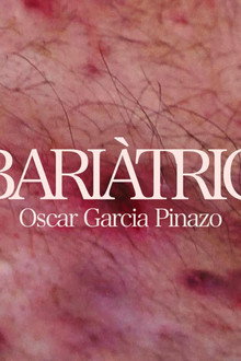 Bariàtric