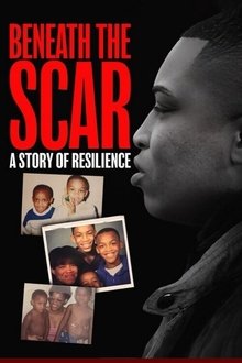 Beneath the Scar: A Story of Resilience Beneath the Scar: A Story of Resilience
