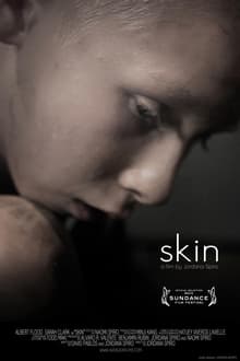 Poster do filme Skin