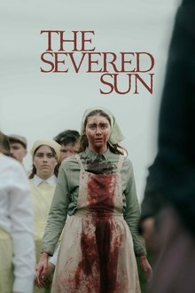 The Severed Sun