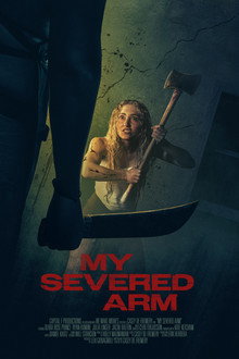 My Severed Arm
