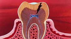La Bouche et les Dents