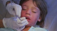 Contamination