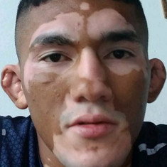 Melquizael Costa