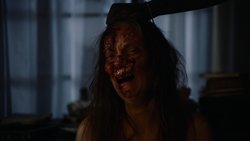 Traumatika