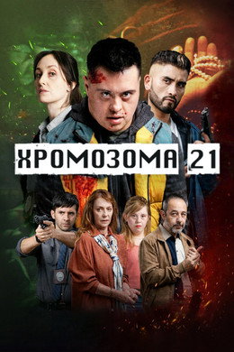 Хромозома 21