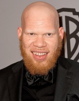 Marvin 'Krondon' Jones III