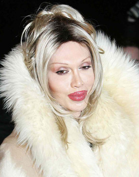 Pete Burns