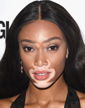 Winnie Harlow