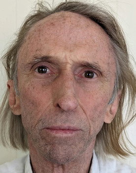 Reg Mombassa