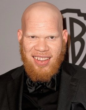 Marvin Jones III as Cysgod