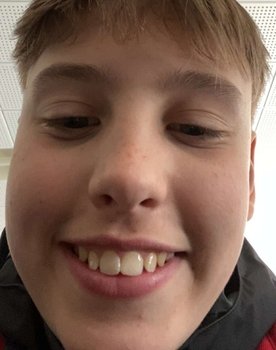 Bært as Hypeman/Slurp and burp
