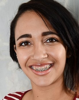Teen Facials 8