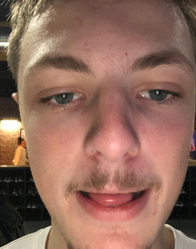 Antoine Queval as Torpie