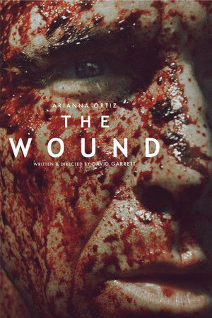 The Wound