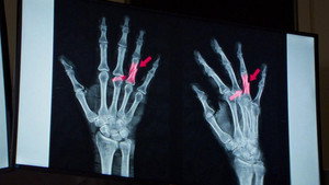 Anatomie d'une chute