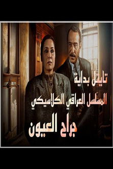 جراح العيون