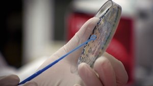 The Superbug Era