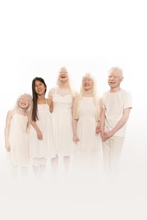Born with Albinism film complet