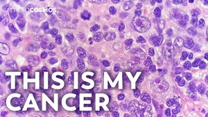 How Do We Find Cancer? still
