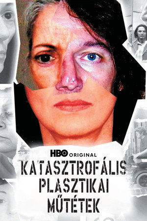 Katasztrofális plasztikai műtétek Katasztrofális plasztikai műtétek