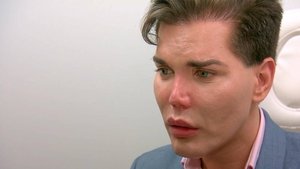 Botched: Season 4 Episode 4