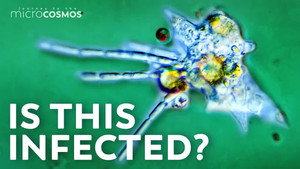 The Case of the Mistaken Amoeba still