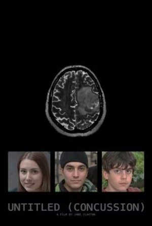 Untitled (Concussion)