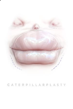 Poster Caterpillarplasty 2018