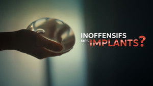 Inoffensifs mes implants