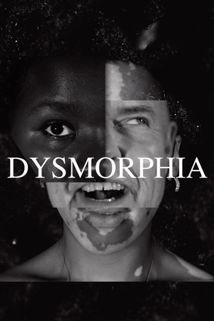 DYSMORPHIA