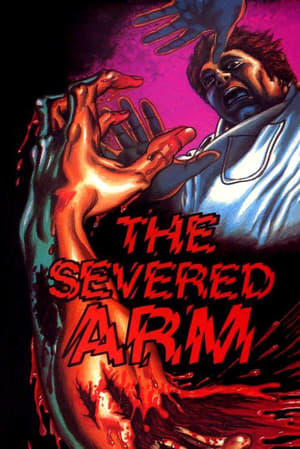 Image The Severed Arm