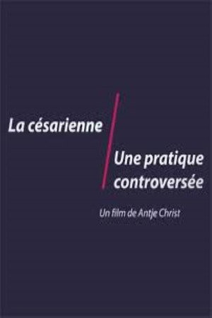 The C-Section Controversy 4