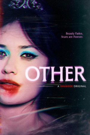 Other 14