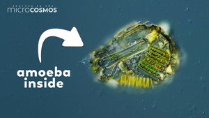 This Amoeba Made Armor From Its Dead Enemies still