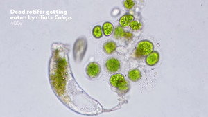 How Do Protozoa Get Around? still