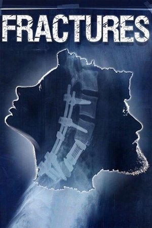 Poster Fractures 2017