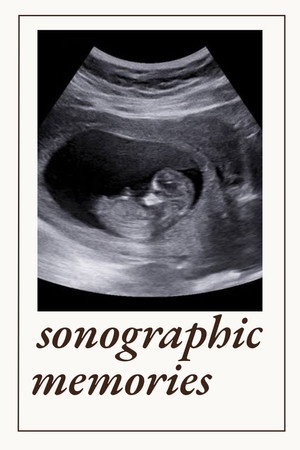 Sonographic Memories